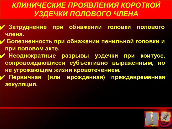 КЛИНИЧЕСКИЕ ПРОЯВЛЕНИЯ КОРОТКОЙ УЗДЕЧКИ ПОЛОВОГО ЧЛЕНА Затруднение при обнажении головки полового