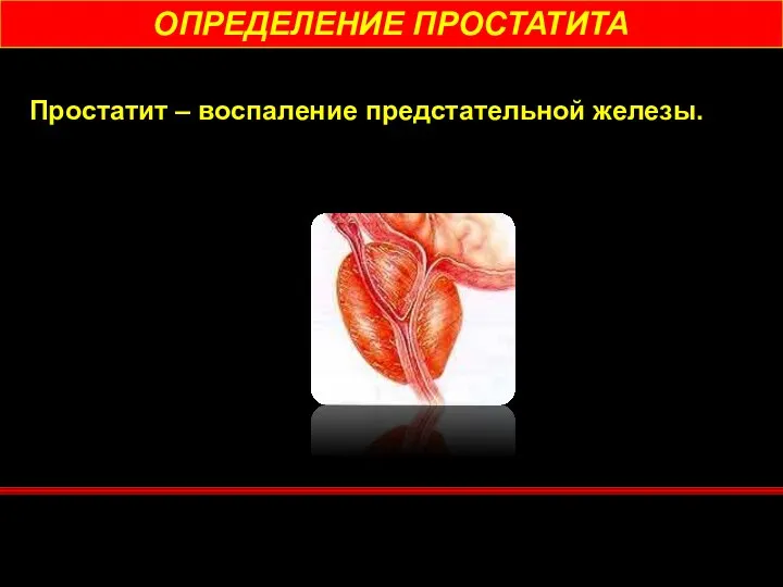 ОПРЕДЕЛЕНИЕ ПРОСТАТИТА Простатит – воспаление предстательной железы.