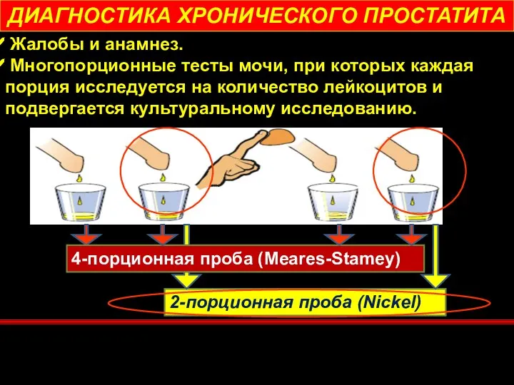 Жалобы и анамнез. Многопорционные тесты мочи, при которых каждая порция исследуется