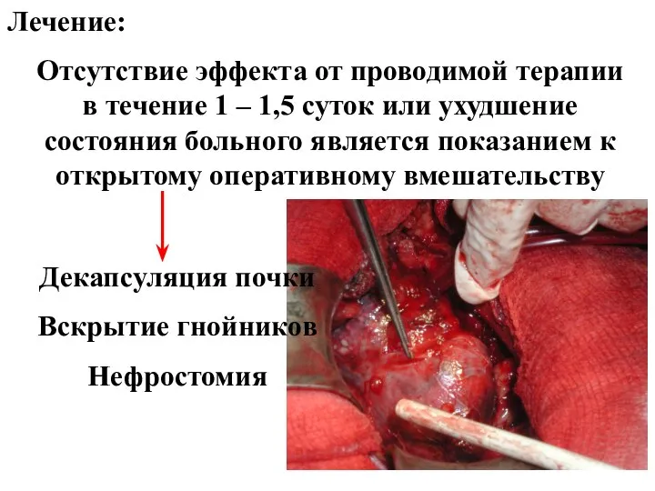 Лечение: Отсутствие эффекта от проводимой терапии в течение 1 – 1,5