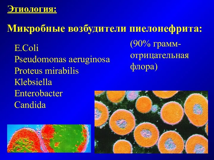 Микробные возбудители пиелонефрита: E.Coli Pseudomonas aeruginosa Proteus mirabilis Кlebsiella Enterobacter Candida (90% грамм- отрицательная флора) Этиология: