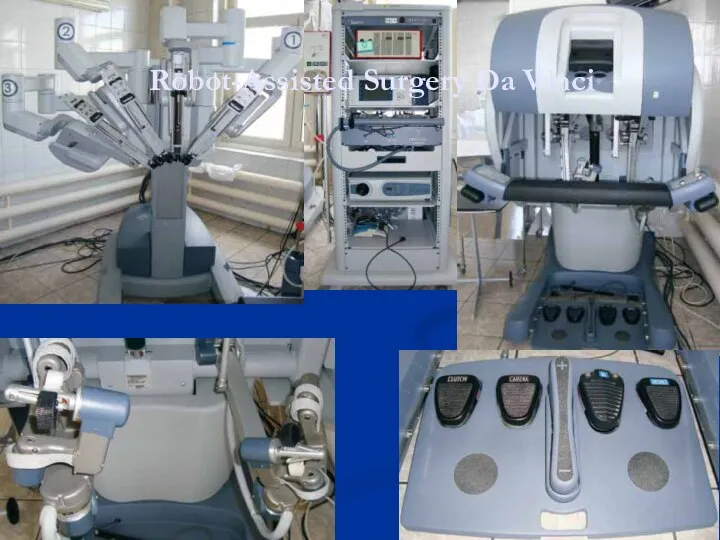 Robot-Assisted Surgery Da Vinci