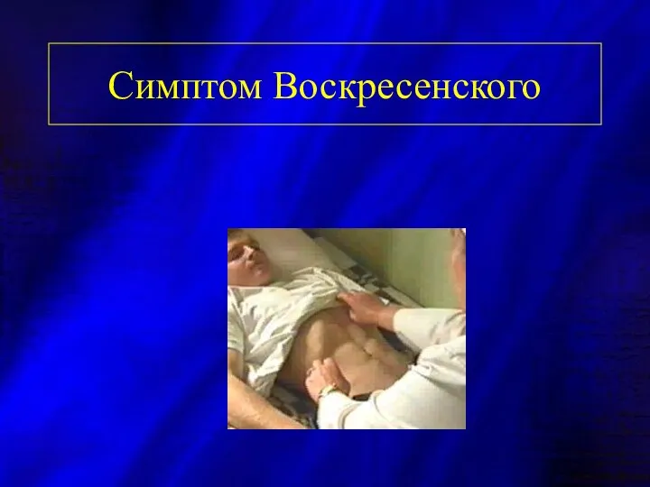 Симптом Воскресенского