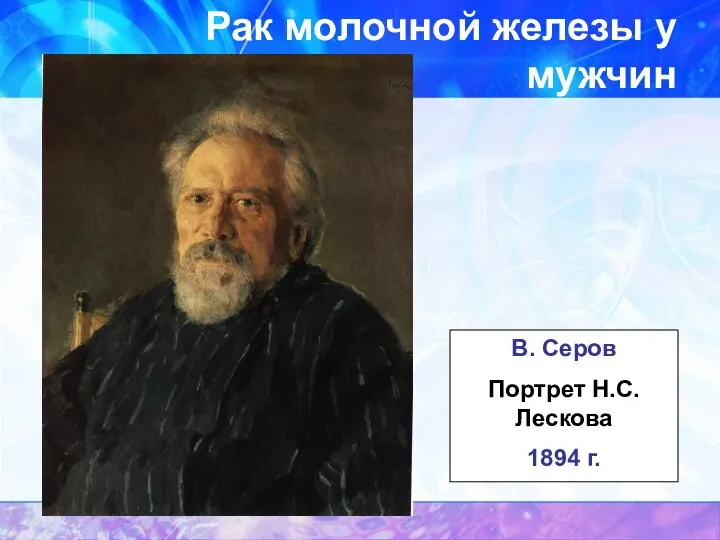 Рак молочной железы у мужчин В. Серов Портрет Н.С.Лескова 1894 г.