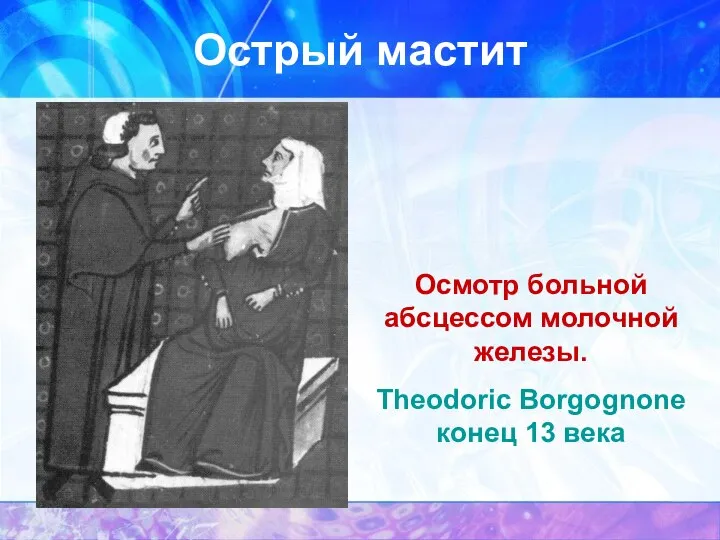 Осмотр больной абсцессом молочной железы. Theodoric Borgognone конец 13 века Острый мастит