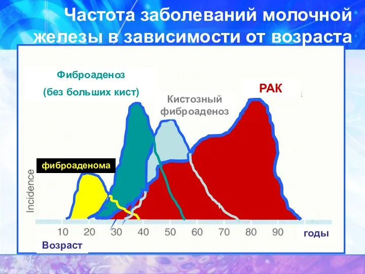 Частота заболеваний молочной железы в зависимости от возраста РАК фиброаденома Фиброаденоз