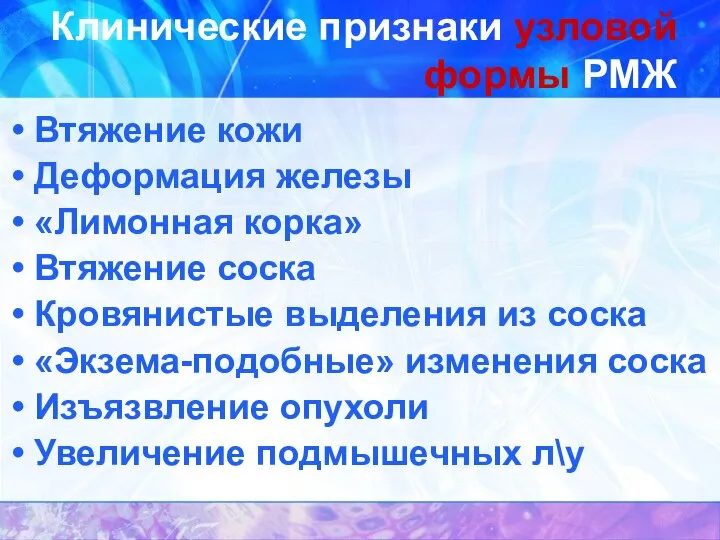 Клинические признаки узловой формы РМЖ Втяжение кожи Деформация железы «Лимонная корка»