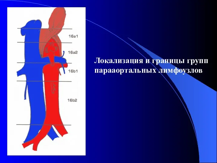 Локализация и границы групп парааортальных лимфоузлов