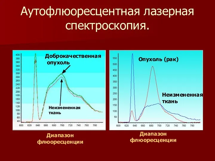 Аутофлюоресцентная лазерная спектроскопия. Опухоль (рак) Неизмененная ткань Диапазон флюоресценции Доброкачественная опухоль Неизмененная ткань Диапазон флюоресценции