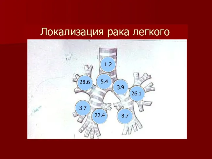 Локализация рака легкого 28.6 1.2 5.4 3.9 26.1 3.7 22.4 8.7