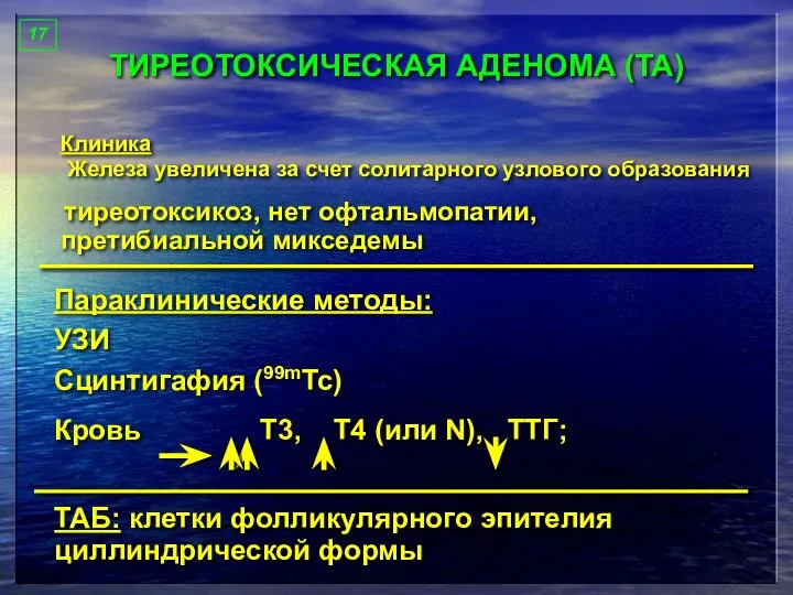 ТИРЕОТОКСИЧЕСКАЯ АДЕНОМА (ТА) Клиника Железа увеличена за счет солитарного узлового образования