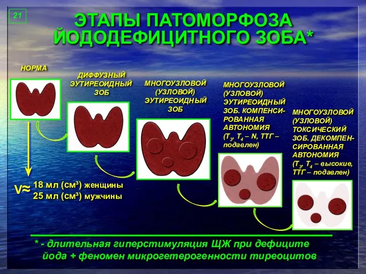 ЭТАПЫ ПАТОМОРФОЗА ЙОДОДЕФИЦИТНОГО ЗОБА* 21 НОРМА ДИФФУЗНЫЙ ЭУТИРЕОИДНЫЙ ЗОБ МНОГОУЗЛОВОЙ (УЗЛОВОЙ)