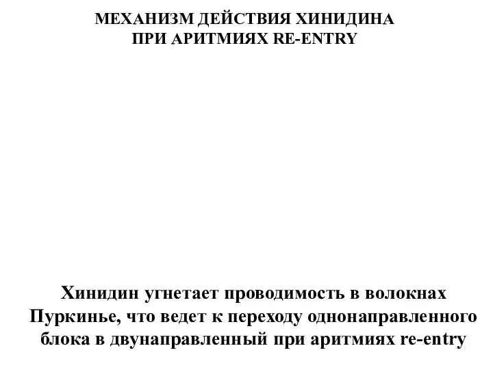 Хинидин угнетает проводимость в волокнах Пуркинье, что ведет к переходу однонаправленного