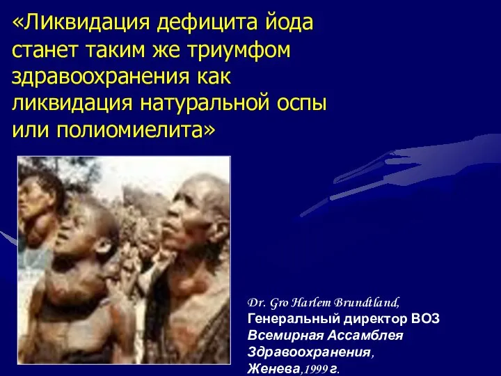 «Ликвидация дефицита йода станет таким же триумфом здравоохранения как ликвидация натуральной