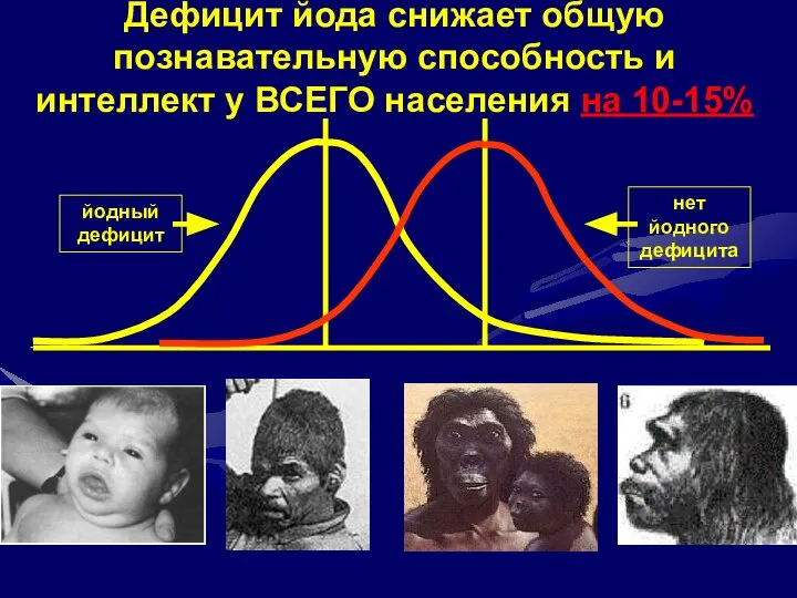 Индекс интеллектуального развития (IQ) йодный дефицит нет йодного дефицита Дефицит йода