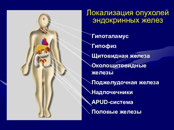 Локализация опухолей эндокринных желез Гипоталамус Гипофиз Щитовидная железа Околощитовидные железы Поджелудочная железа Надпочечники APUD-система Половые железы