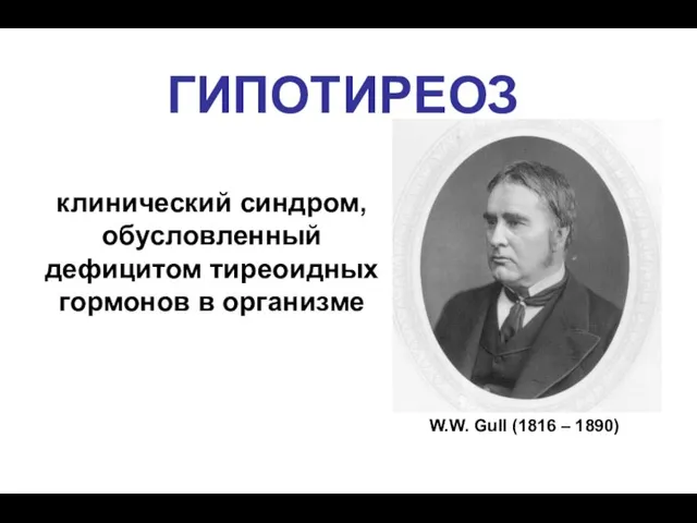 ГИПОТИРЕОЗ клинический синдром, обусловленный дефицитом тиреоидных гормонов в организме W.W. Gull (1816 – 1890)