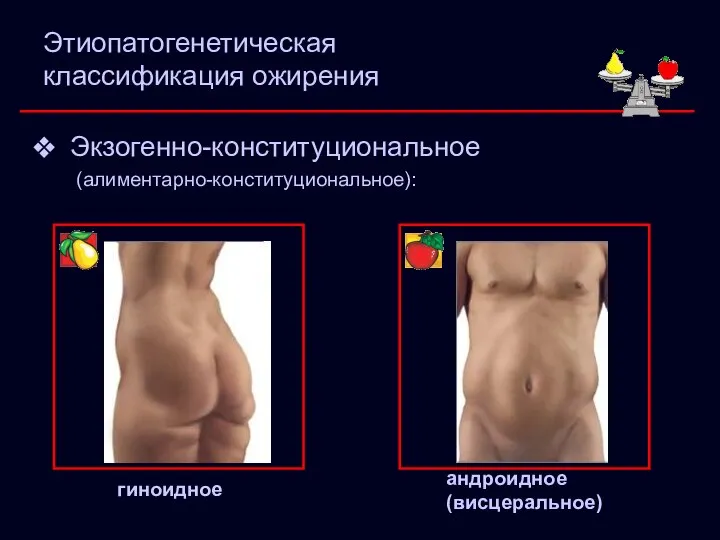 Этиопатогенетическая классификация ожирения Экзогенно-конституциональное (алиментарно-конституциональное): гиноидное андроидное (висцеральное)