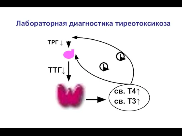 Лабораторная диагностика тиреотоксикоза ТРГ ↓ ТТГ↓ св. Т4↑ св. Т3↑