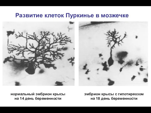 Развитие клеток Пуркинье в мозжечке нормальный эмбрион крысы на 14 день