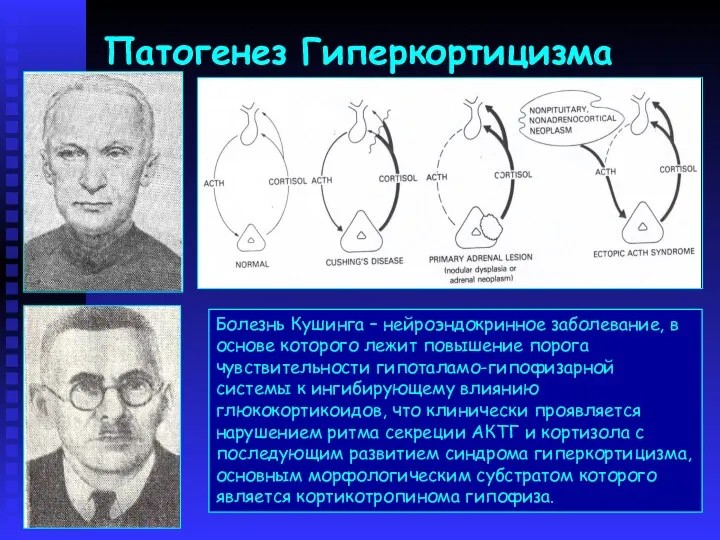 Патогенез Гиперкортицизма Болезнь Кушинга – нейроэндокринное заболевание, в основе которого лежит