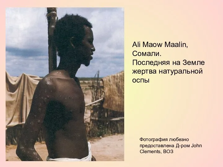 Ali Maow Maalin, Сомали. Последняя на Земле жертва натуральной оспы Фотография