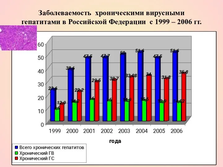 Заболеваемость хроническими вирусными гепатитами в Российской Федерации с 1999 – 2006 гг.