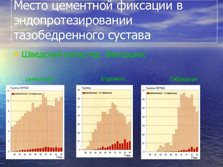 Место цементной фиксации в эндопротезировании тазобедренного сустава Шведский регистер. Фиксация: Цементная Б\цемент. Гибридная