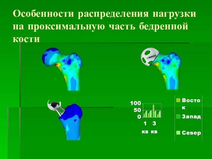 Особенности распределения нагрузки на проксимальную часть бедренной кости