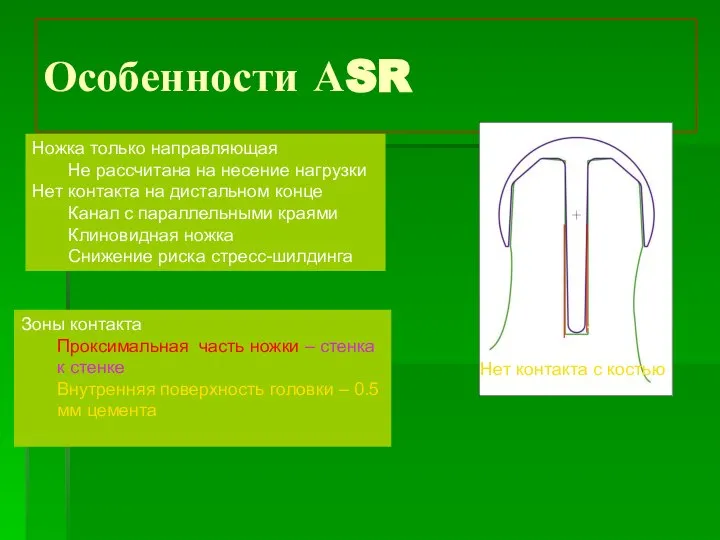 Особенности АSR Ножка только направляющая Не рассчитана на несение нагрузки Нет