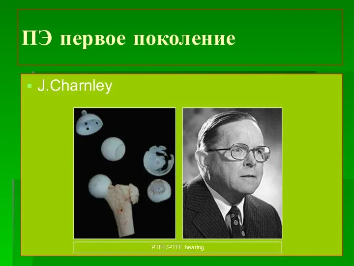ПЭ первое поколение J.Charnley