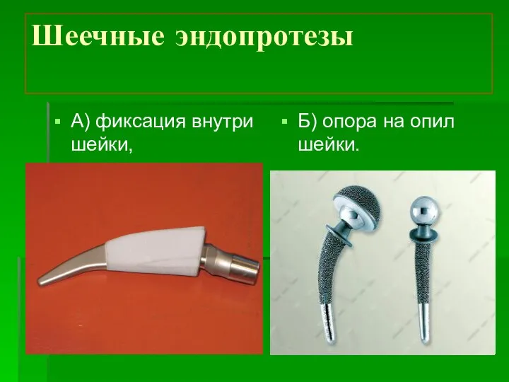 Шеечные эндопротезы А) фиксация внутри шейки, Б) опора на опил шейки.