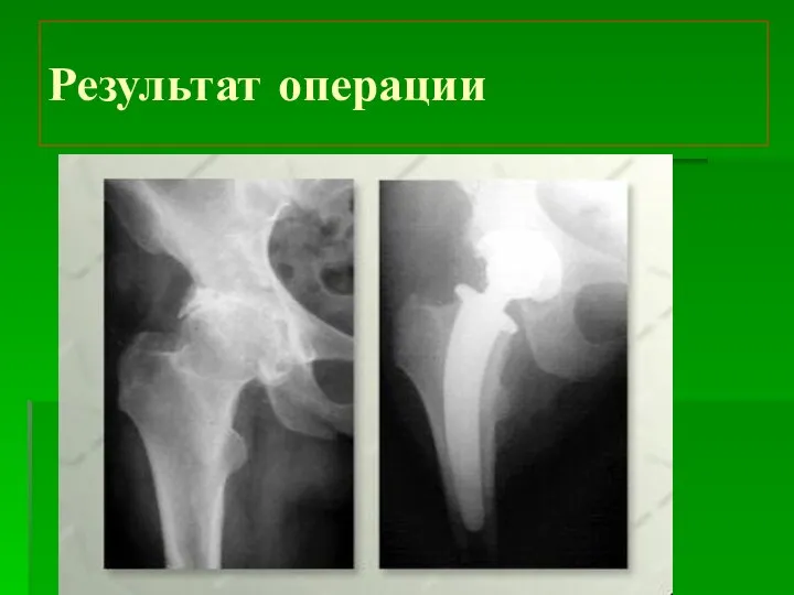 Результат операции