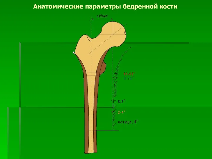 Анатомические параметры бедренной кости