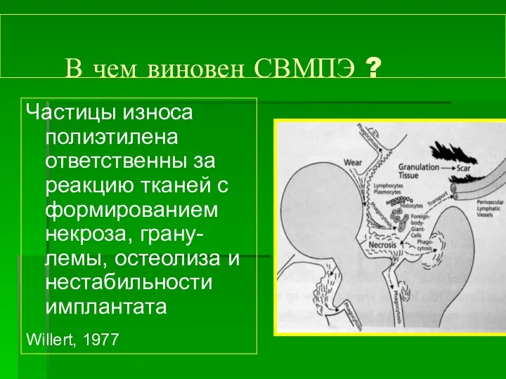 В чем виновен СВМПЭ ? Частицы износа полиэтилена ответственны за реакцию