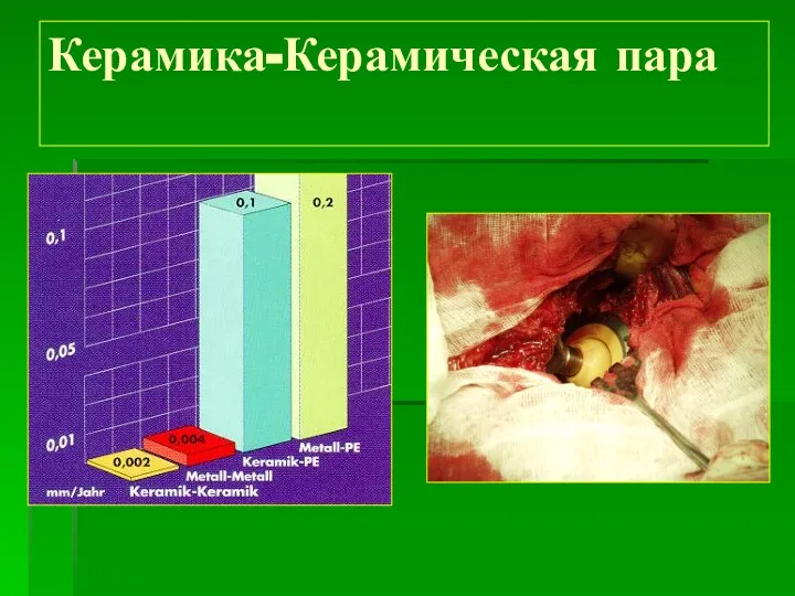 Керамика-Керамическая пара