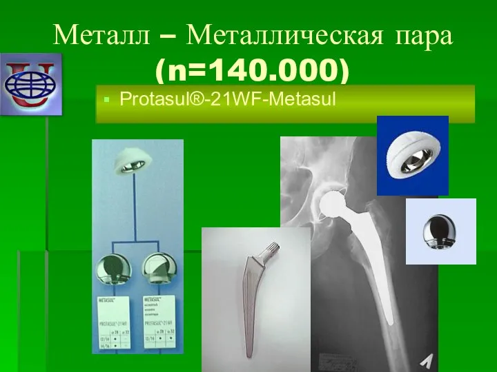 Металл – Металлическая пара (n=140.000) Protasul®-21WF-Metasul