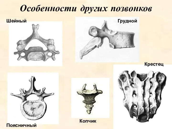 Особенности других позвонков Шейный Грудной Поясничный Копчик Крестец