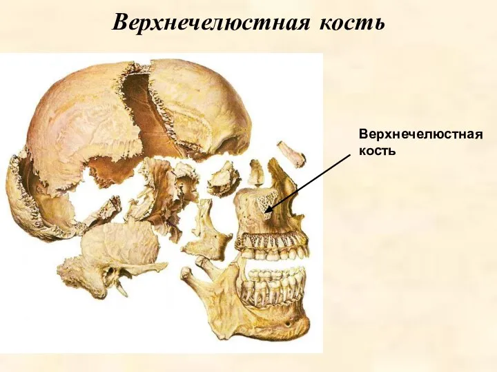 Верхнечелюстная кость Верхнечелюстная кость