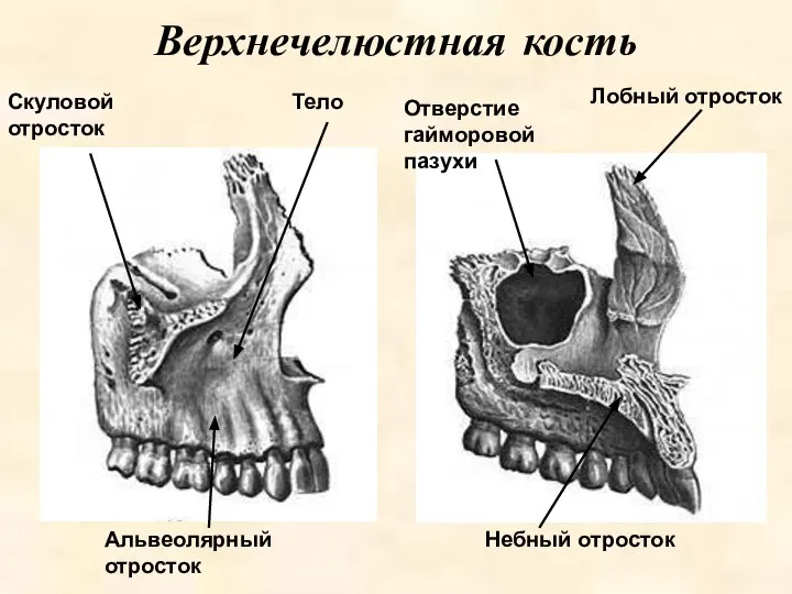 Лобный отросток Верхнечелюстная кость Небный отросток Скуловой отросток Тело Альвеолярный отросток Отверстие гайморовой пазухи