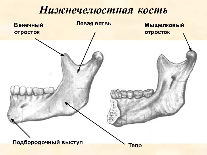 Мыщелковый отросток Нижнечелюстная кость Левая ветвь Венечный отросток Тело Подбородочный выступ