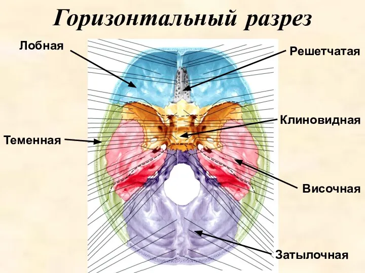 Горизонтальный разрез Лобная Височная Клиновидная Теменная Решетчатая Затылочная