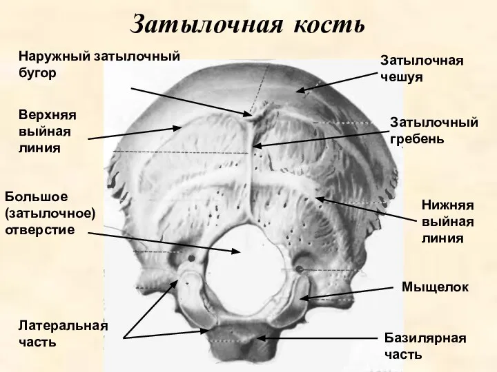 Затылочная кость Наружный затылочный бугор Большое (затылочное) отверстие Базилярная часть Затылочная