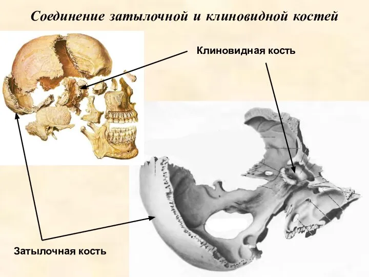Соединение затылочной и клиновидной костей Затылочная кость Клиновидная кость