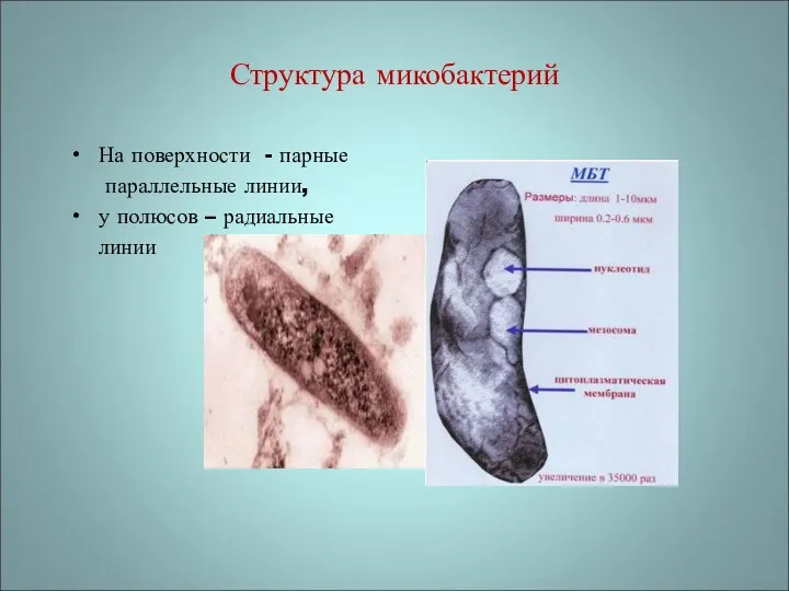 Структура микобактерий На поверхности - парные параллельные линии, у полюсов – радиальные линии