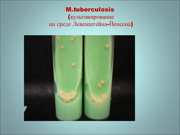 M.tuberculosis (культивирование на среде Левенштейна-Йенсена)