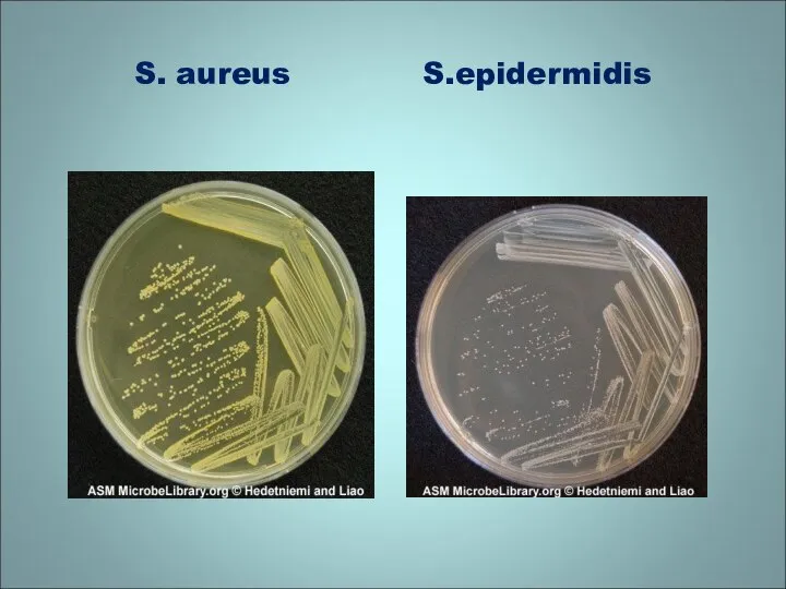 S. aureus S.epidermidis