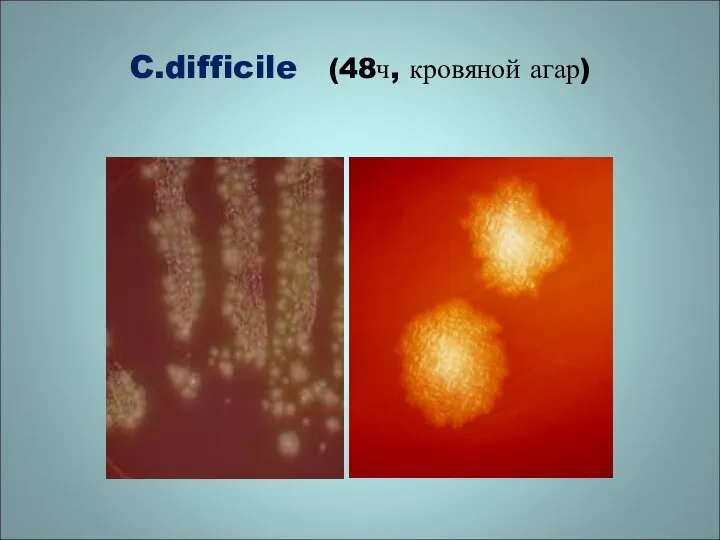 C.difficile (48ч, кровяной агар)