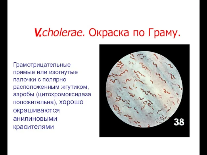 V.cholerae. Окраска по Граму. Грамотрицательные прямые или изогнутые палочки с полярно