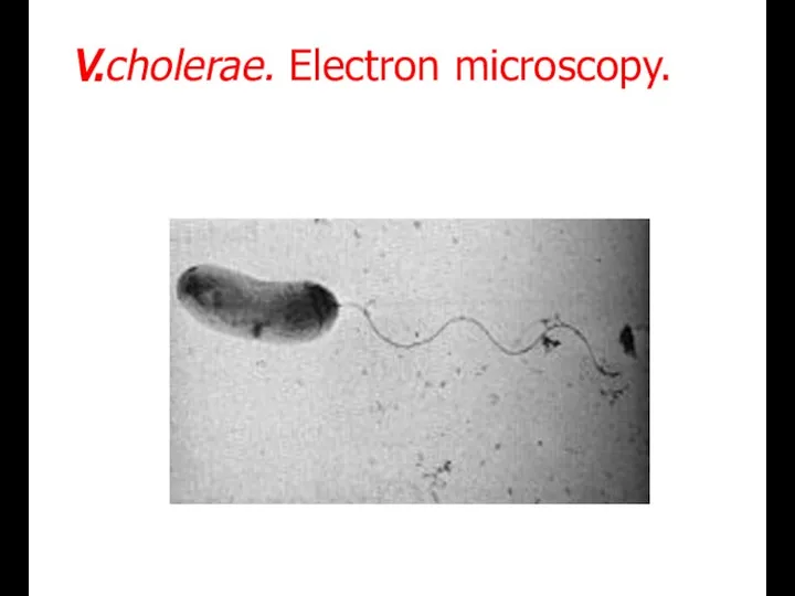 V.cholerae. Electron microscopy.